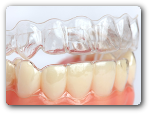 machine Suri Materialism Tipuri de aparate dentare - Clinica StomaCare Turda